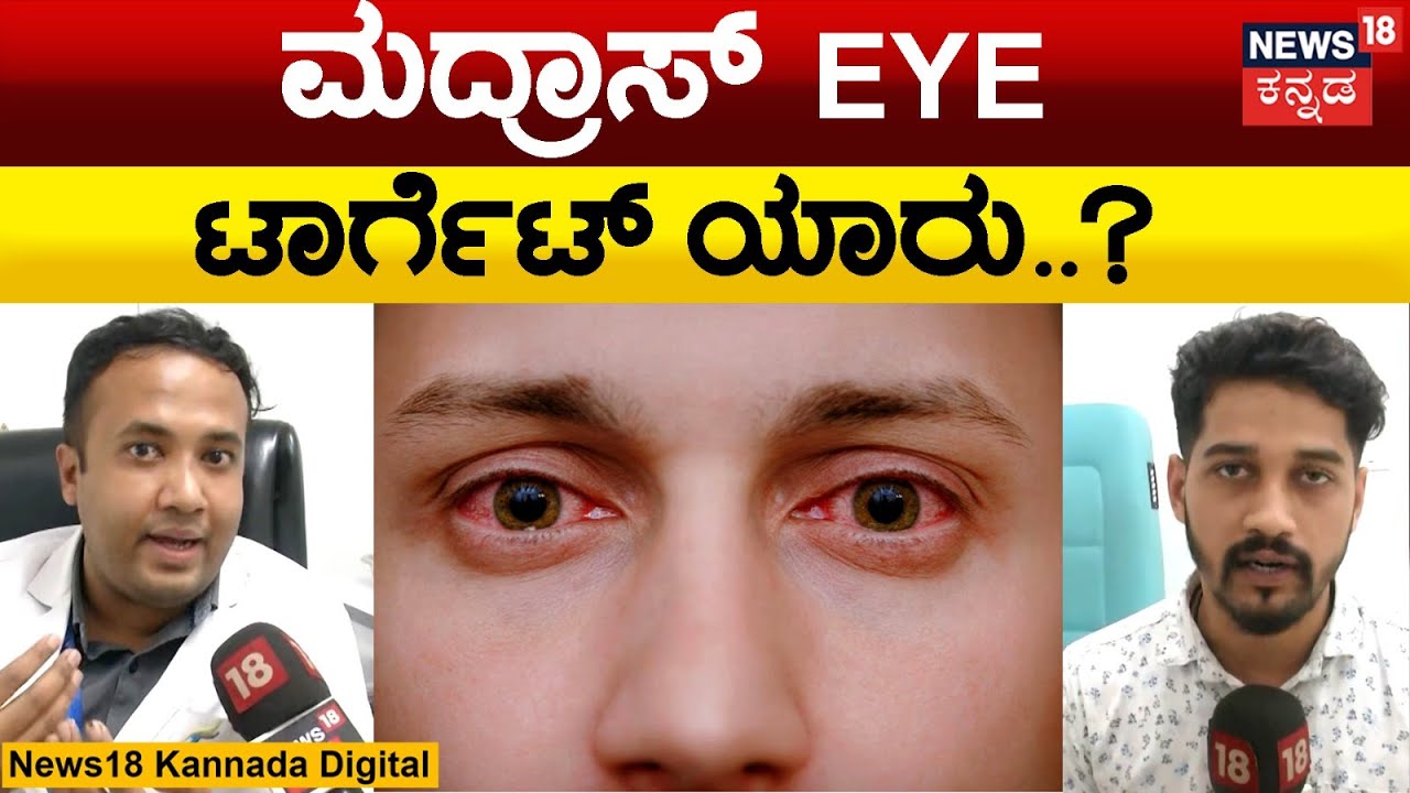 Madras Eye Problem | ಕೆಂಪು ಕಣ್ಣಿನ ಬಗ್ಗೆ ತಜ್ಞರ ಎಚ್ಚರಿಕೆಯೇನು? | Narayana Nethralaya