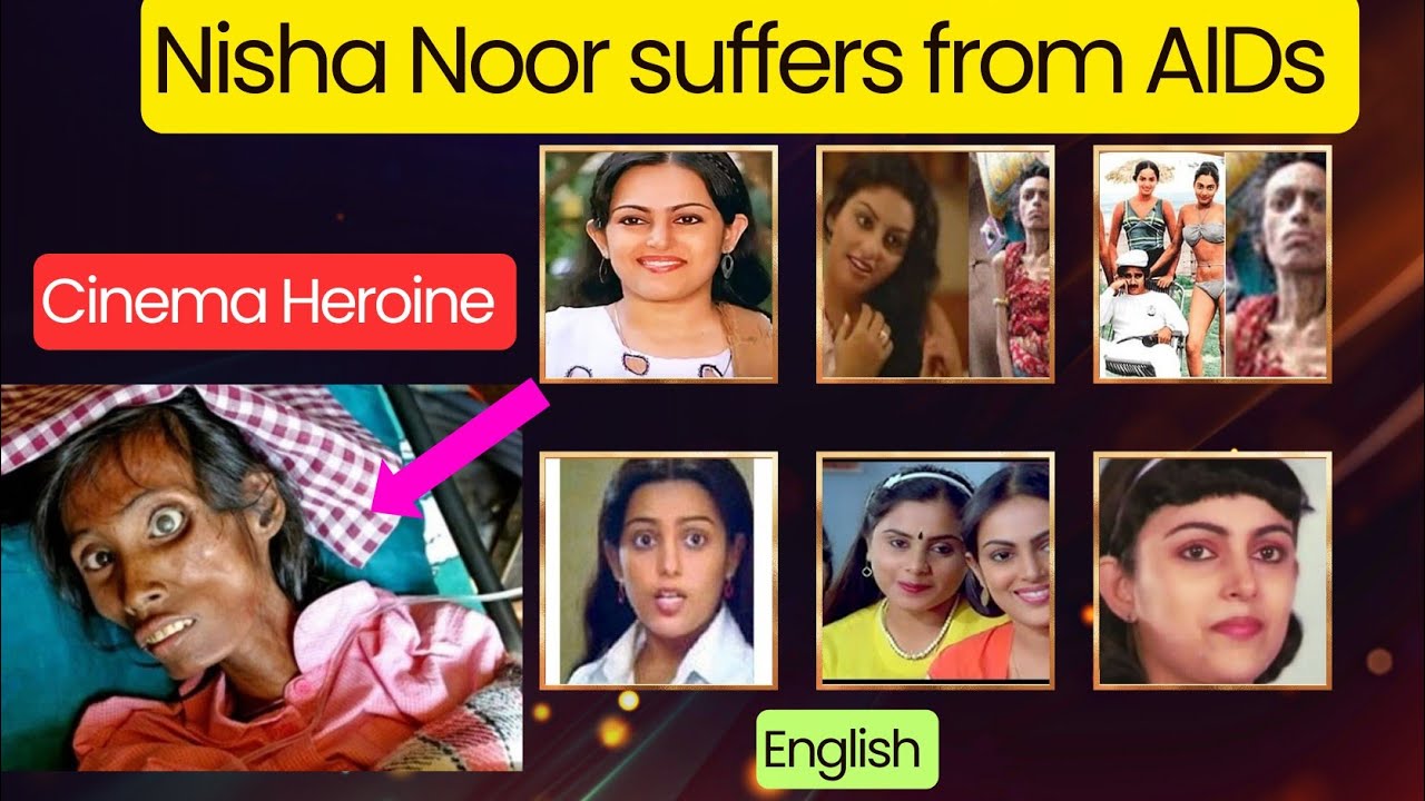 Nisha Noor Suffering from Aids | Full story | What Happened Her?
