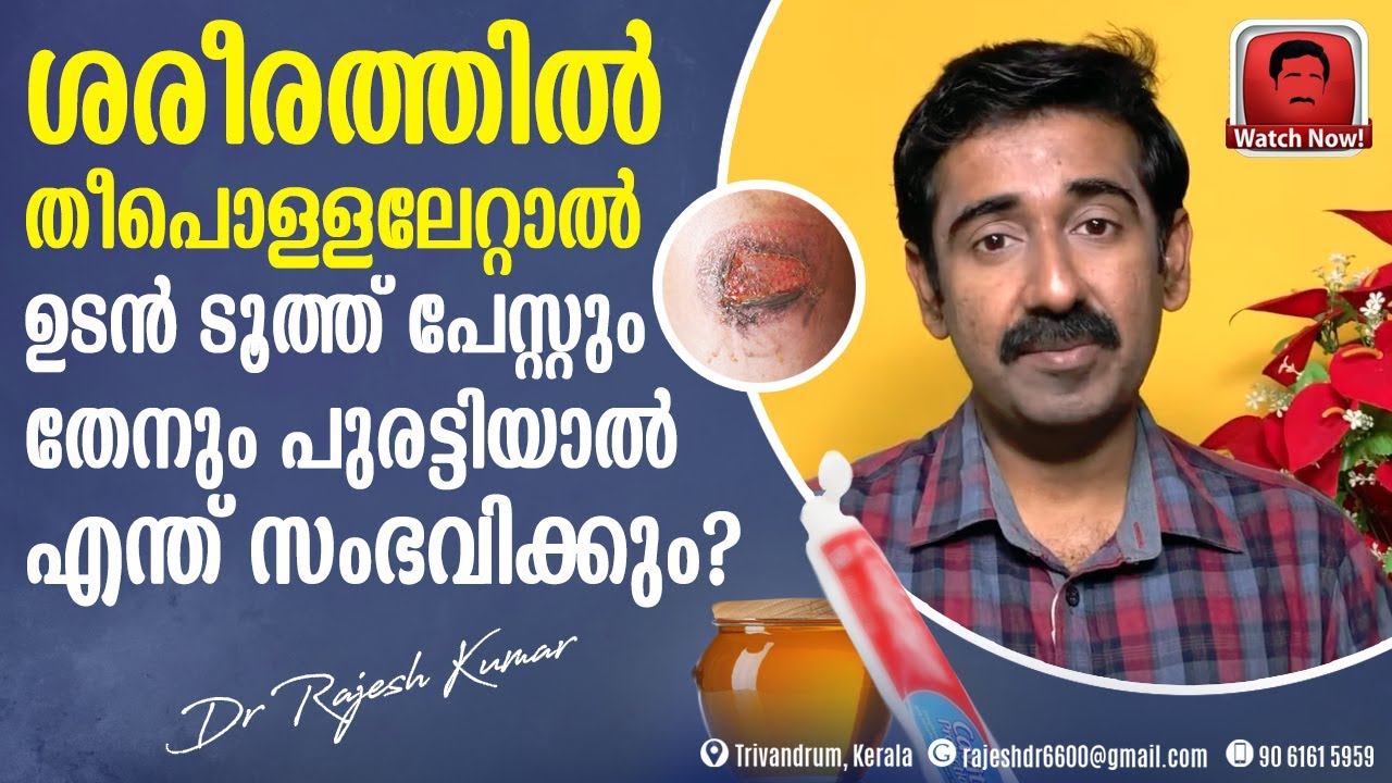 ശരീരത്തിൽ തീപൊള്ളലേറ്റാൽ ഉടൻ ടൂത്ത് പേസ്റ്റും തേനും പുരട്ടിയാൽ എന്ത് സംഭവിക്കും ?