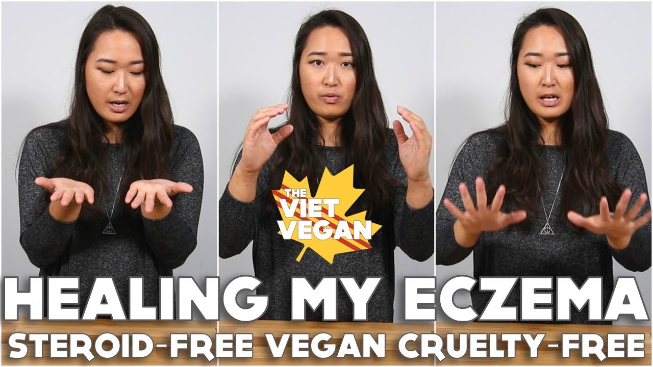 Healing My Eczema [ Steroid-free, Vegan & Cruelty Free ] ft. BetterHelp