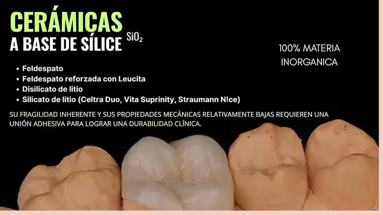 Cerámicas vítreas dentales