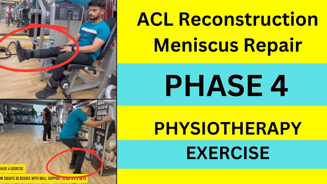 ACL Reconstruction and Meniscus Repair I Phase 4 Physiotherapy and Exercise