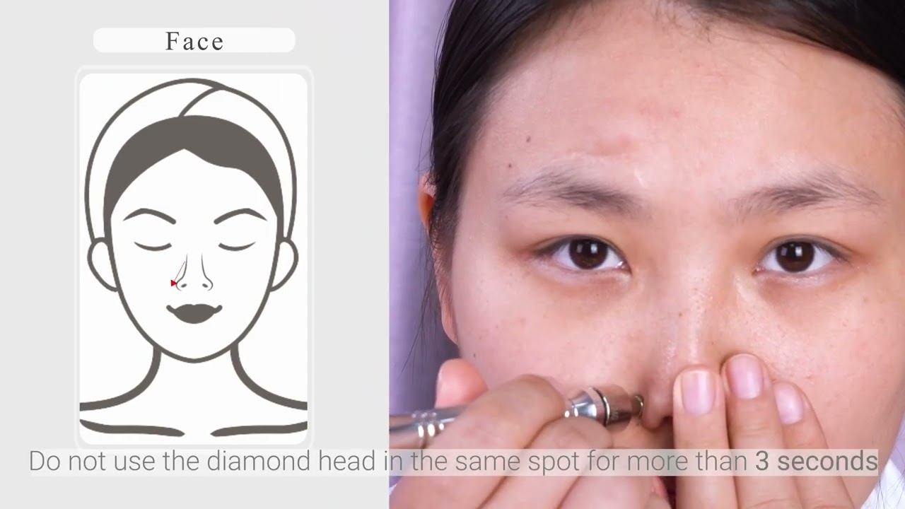 UNOISETION Diamond Microdermabrasion Machine