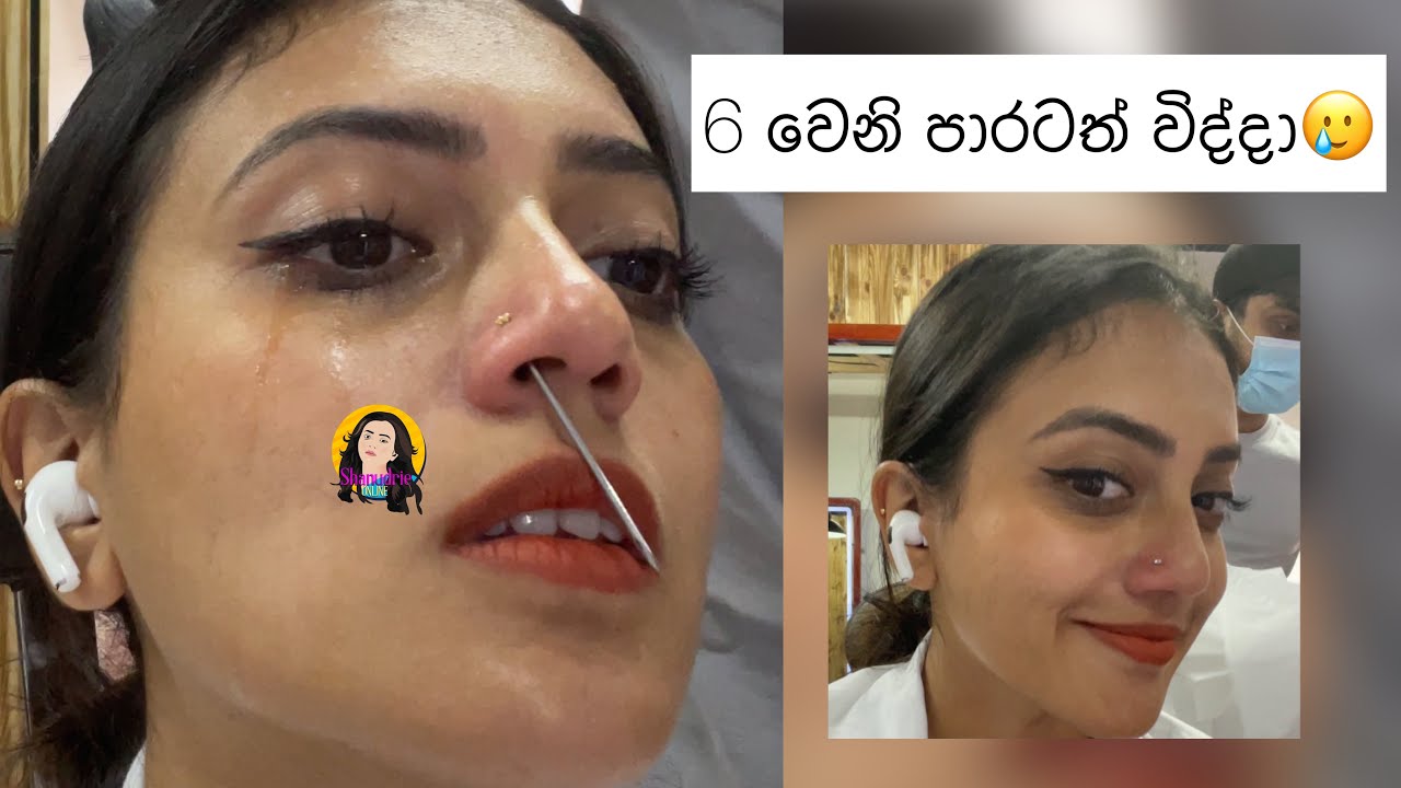 ආයෙත් විද්දා😩