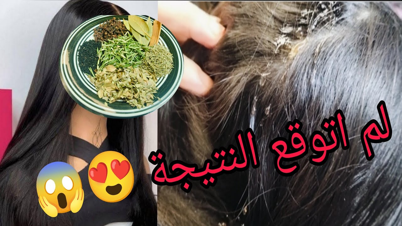 #مطبخ_ام_وسيم /لم اتوقع النتيجة😱😍تعانين  من شعر غير صحي⁉️ تقصف وقشرة بدون زيادة الطول اليك العلاج❤