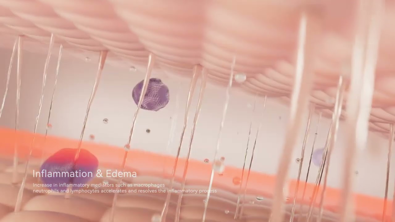 Laser Beauty Device Demo &ndash; Real Test on Skin!