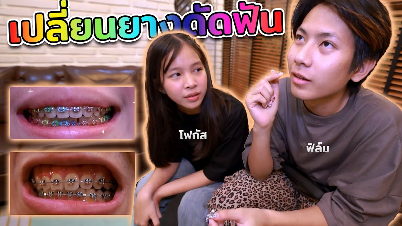โฟกัส และ ฟิล์ม หมอนัด เปลี่ยนยางดัดฟัน สีใหม่ ไฉไลวิ๊งวับ กว่าเดิม!!! ( คลินิกทันตกรรมเดนทัลลอฟท์ )