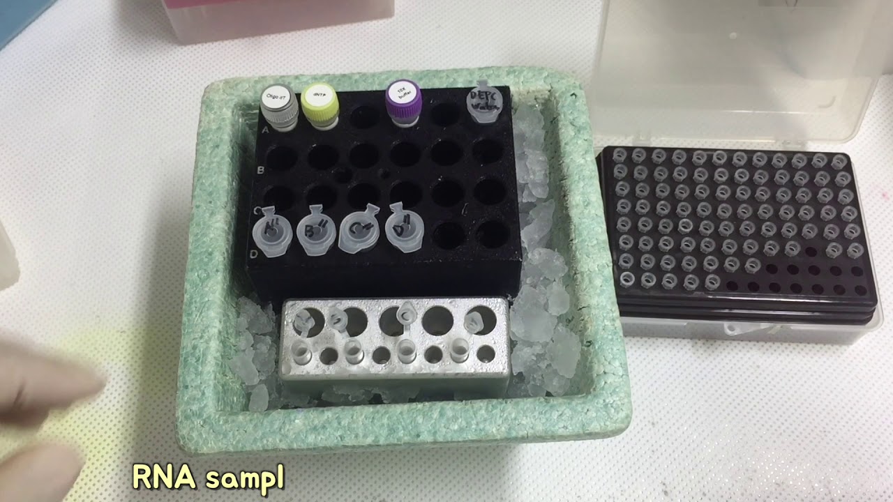 cDNA synthesis