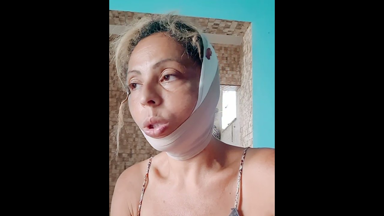 Lifting fácil 1 dia