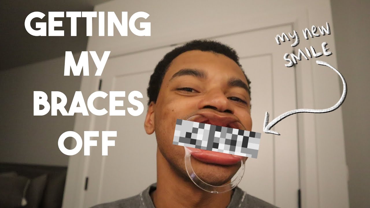 FINALLY GETTING MY BRACES OFF
