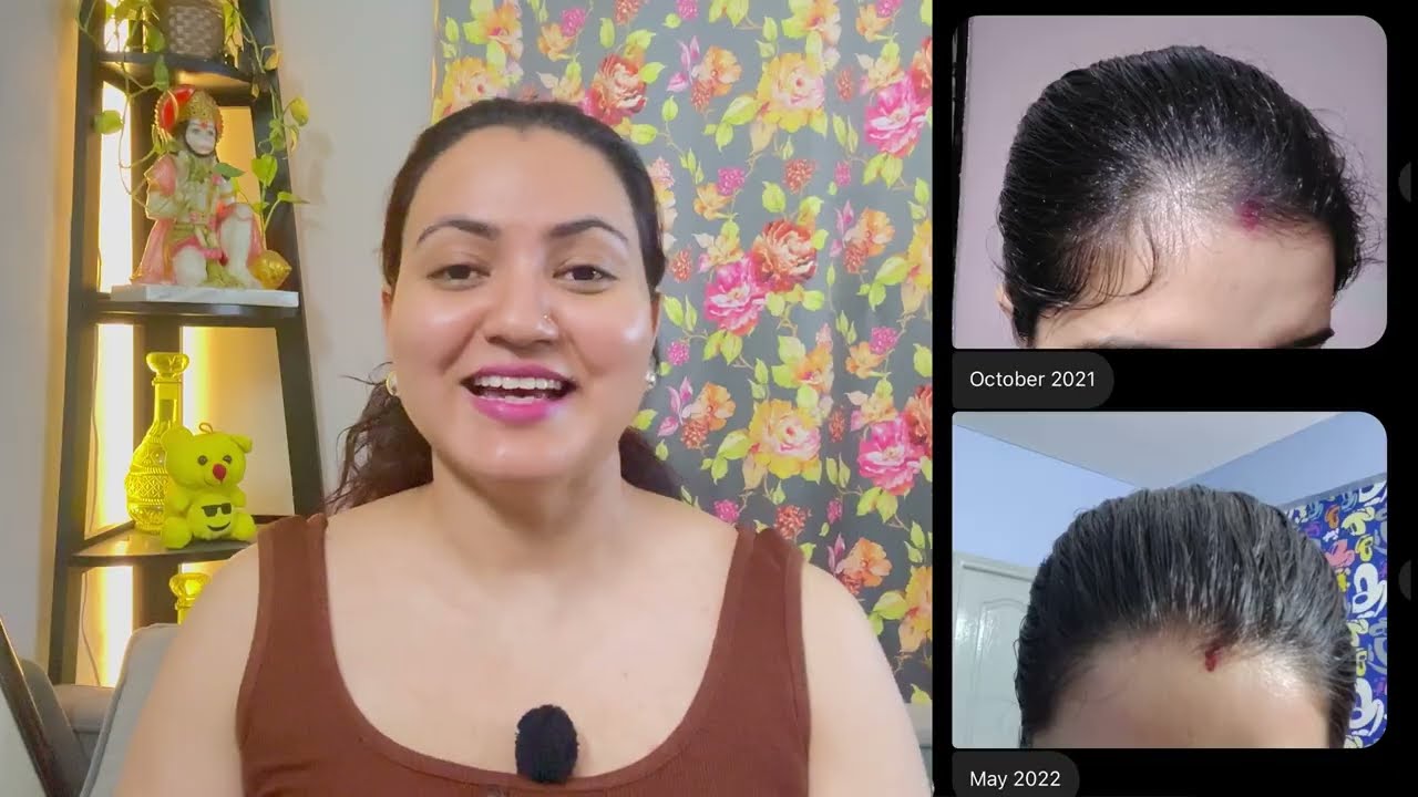 3 Ways To Use Onion Juice For Faster, Thicker & Longer Hair Growth | 100% Results