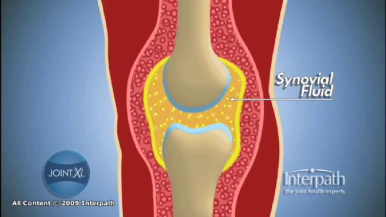 Synovial Fluid