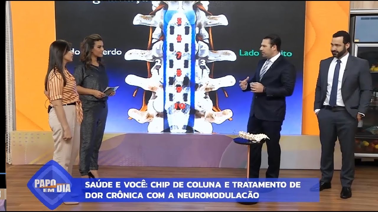 O Chip de coluna e a revolução do tratamento de dor crônica com a neuromodulacão