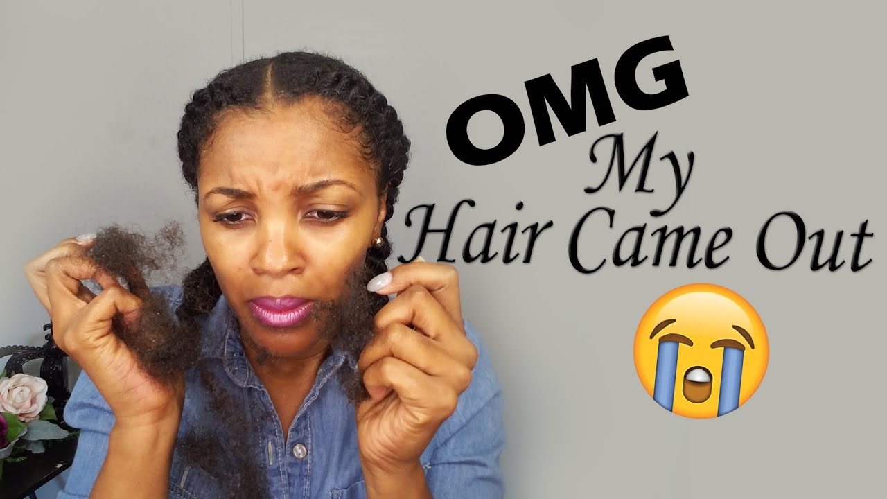 My Hair Came Out After Crochet Braids