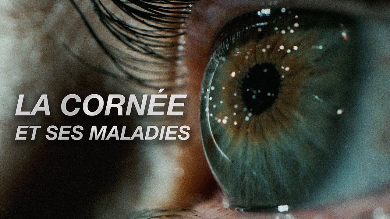 Les pathologies de la cornée : Keratocône, etc