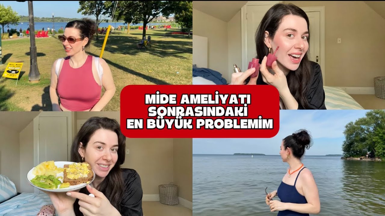 MİDE AMELİYATI SONRASI YAŞADIĞIM EN BÜYÜK SORUN 👇🏻EN SEVDİĞİM ALLIKLAR 👇🏻HAFTALIK VLOG
