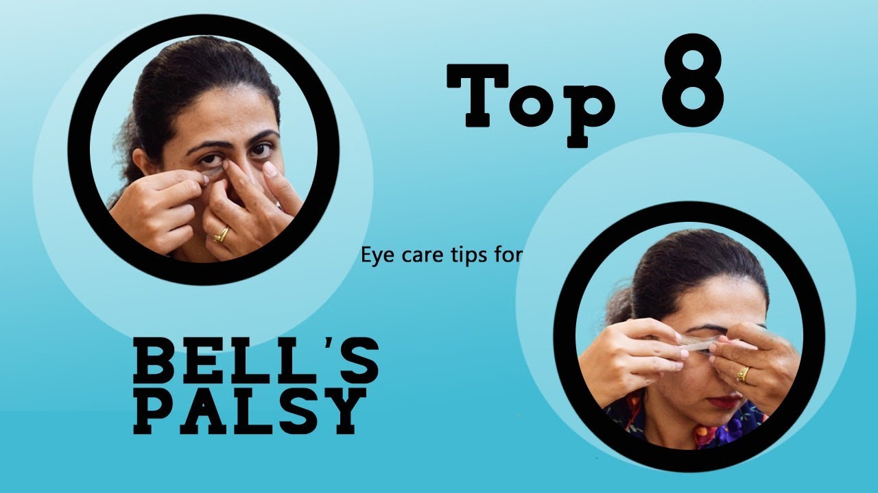 Top 8 Eye care tips for BELL'S PALSY