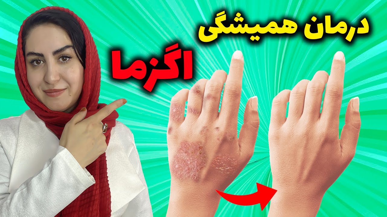 اگزما و حساسیت پوستی: انواع اگزما و درمان سریع آن به روش 💯 طبیعی