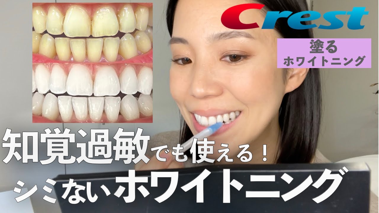 【最新版ホワイトニング】シミない！痛くない！知覚過敏でも使えるホワイトニング方法をご紹介します