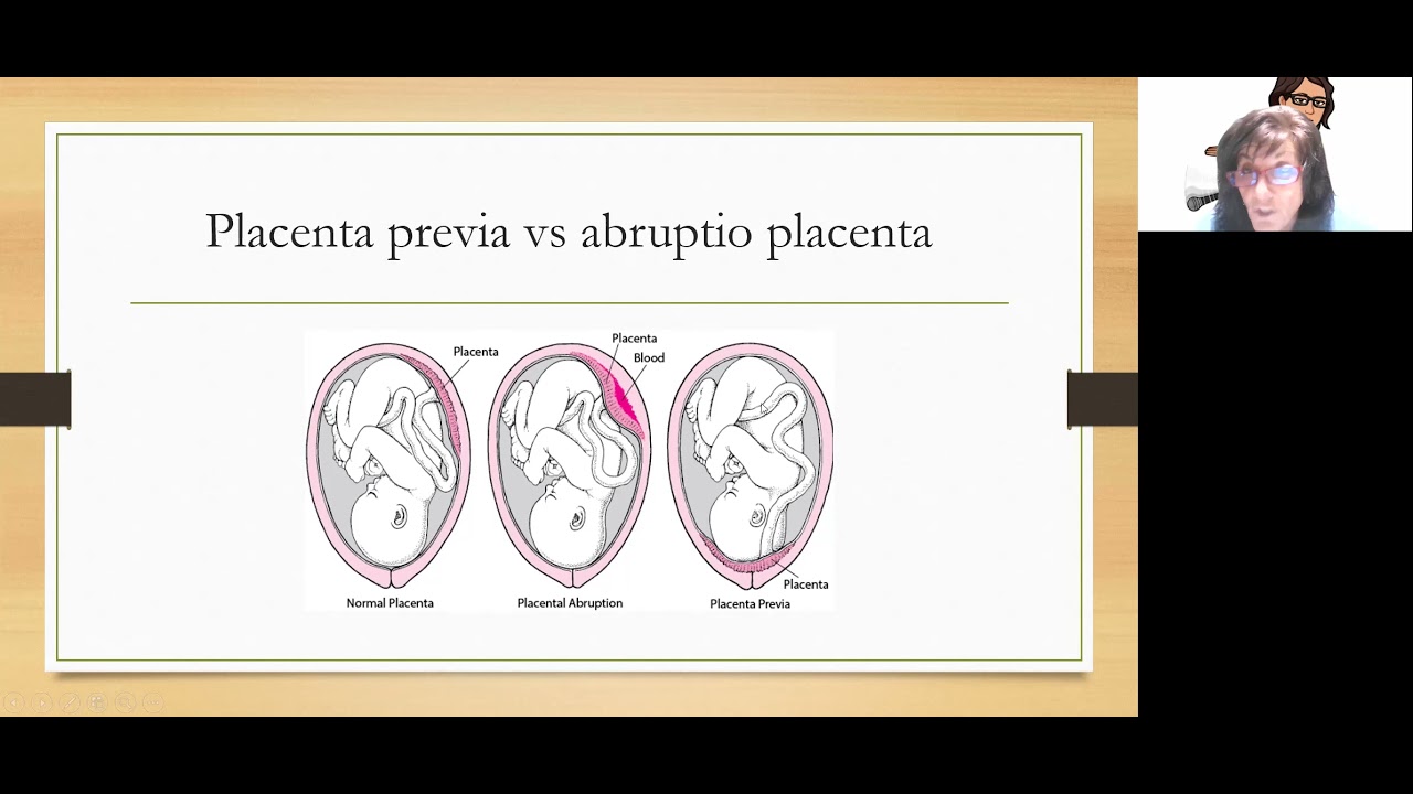 Maternal Newborn Part 1