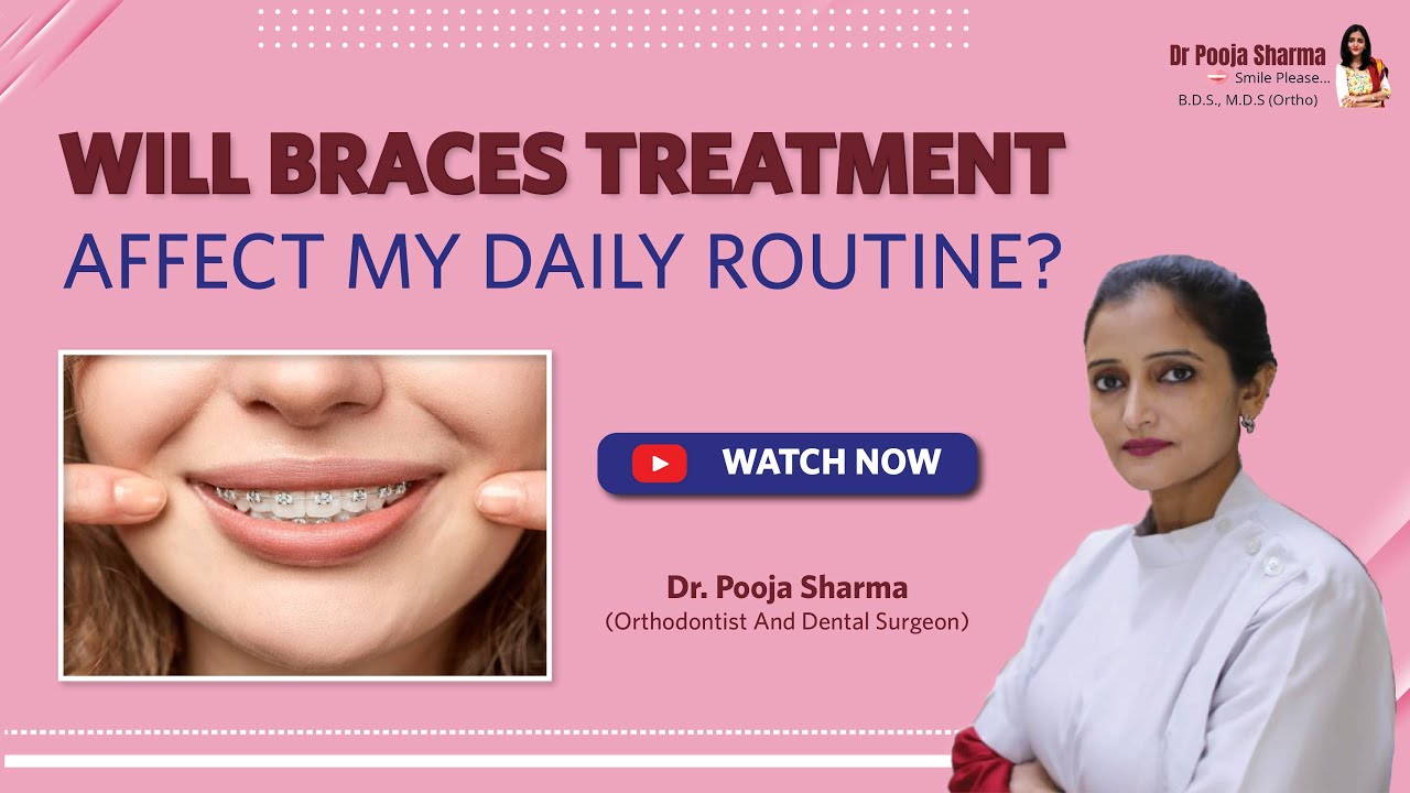 Tips To Make Your Braces Treatment Successful- Braces Treatment In Agra, UP - Dr. Pooja Sharma