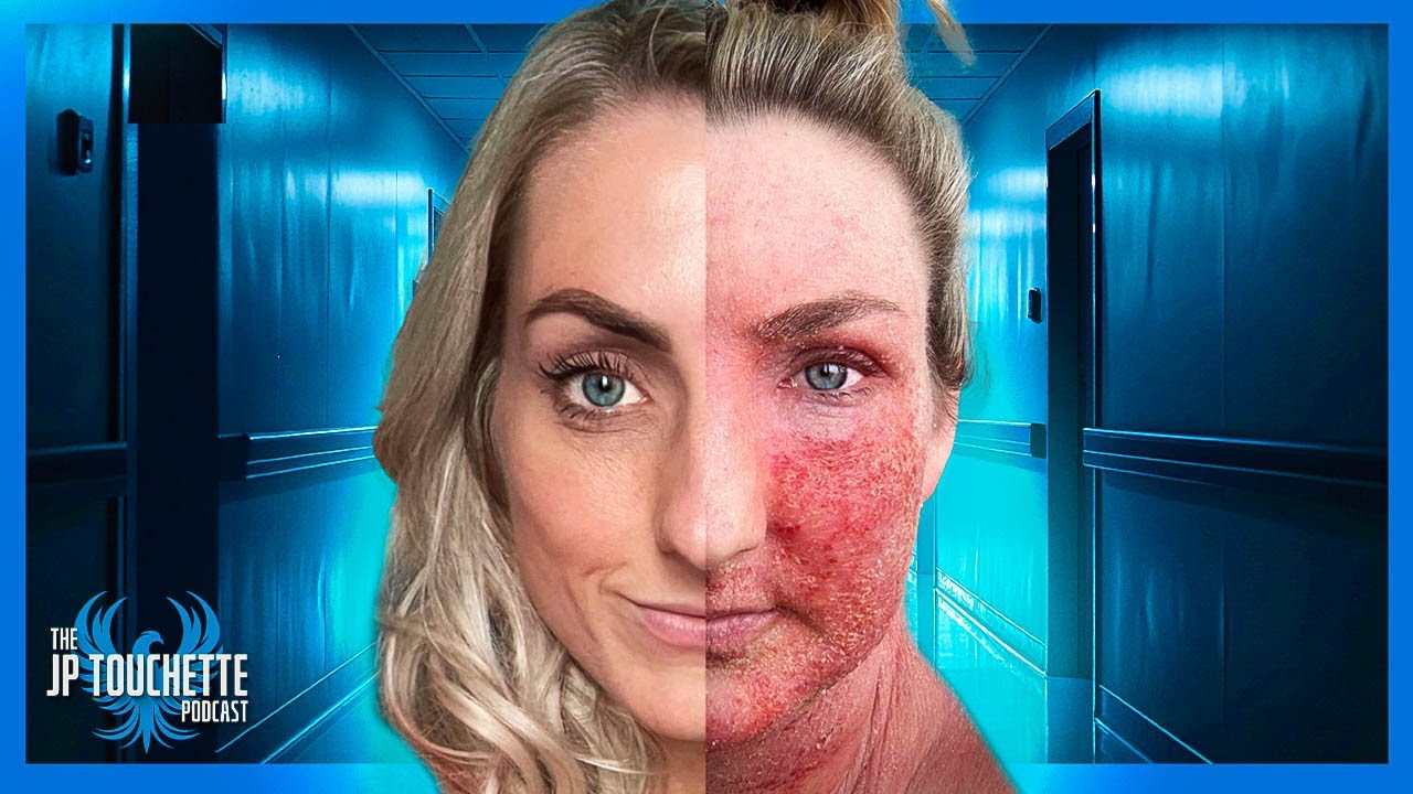 Single Mom vs. Topical Steroid Withdrawal | Amy Aston | EP 24