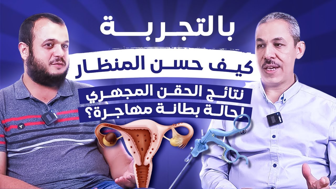 نتيجة المنظار قبل الحقن المجهري لحالة بطانة رحم مهاجرة