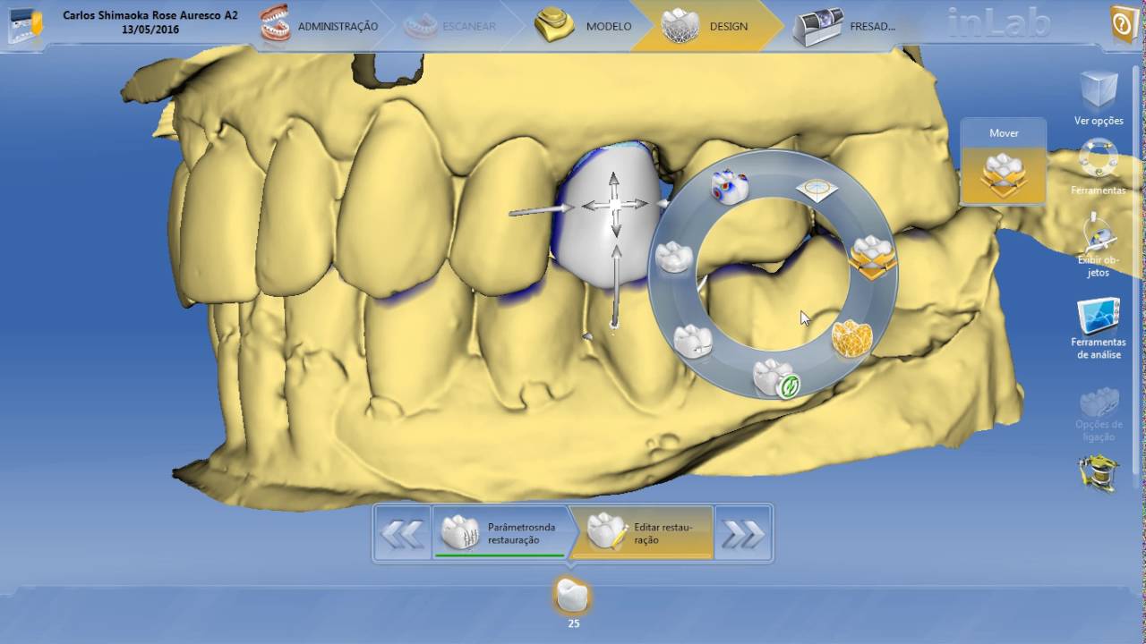 Cad/Cam Cerec Sirona 25