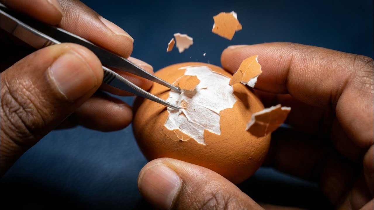 RAW EGG SURGERY 😳😳🔥🔥