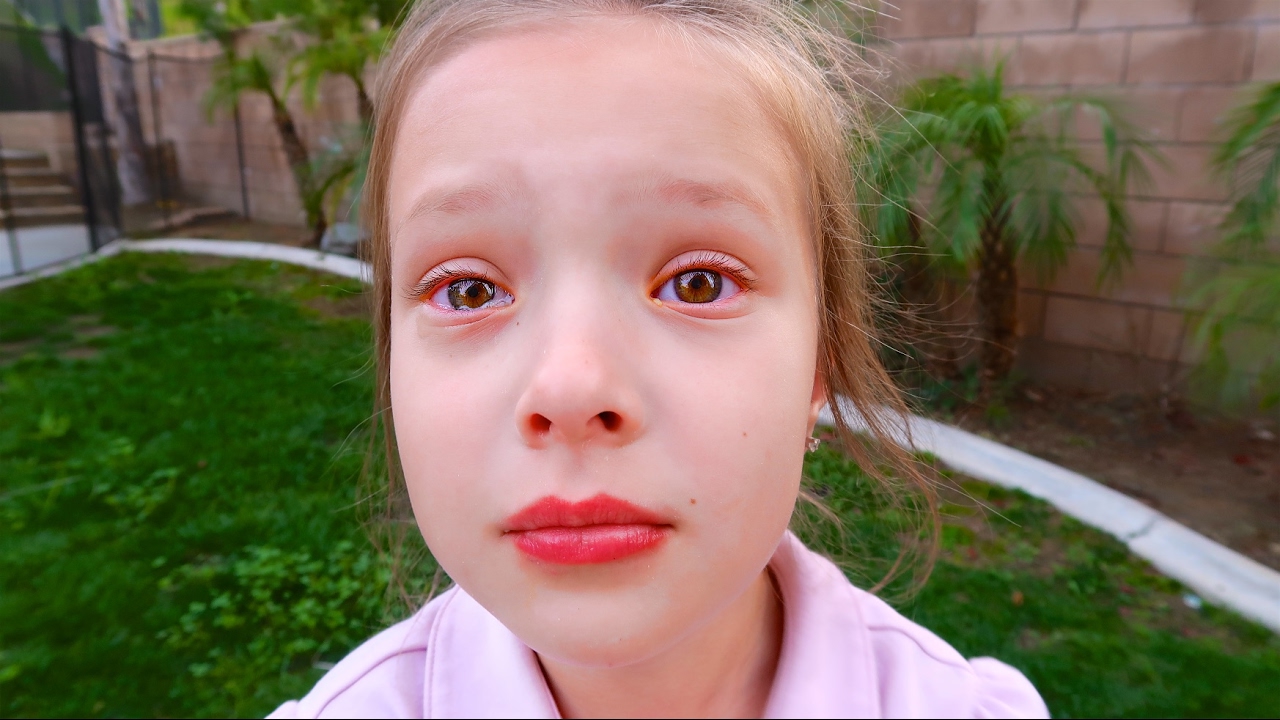 😢 HER FIRST PINK EYE! 👀
