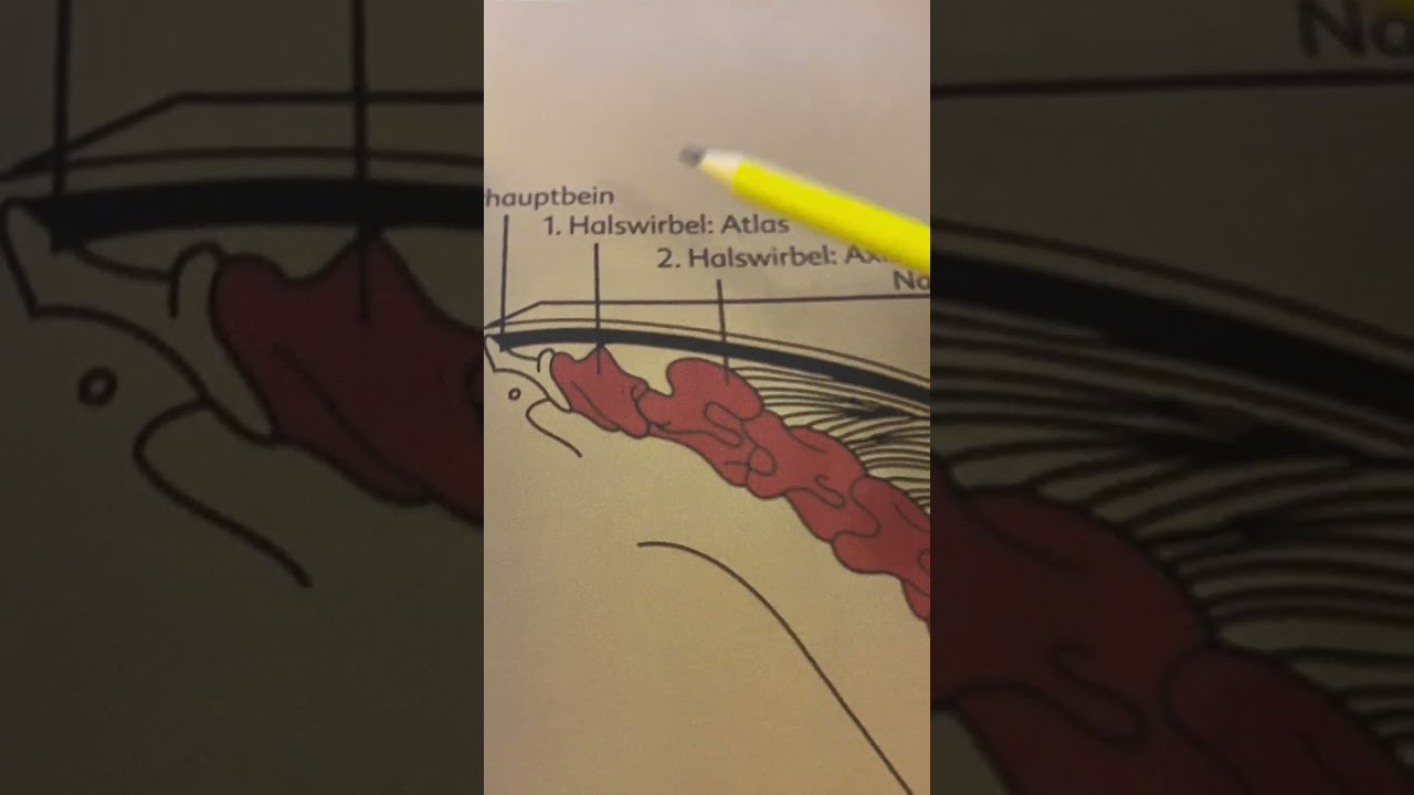 Der falsche Knick beim Pferd, Gefügestörungen, CTÜ
