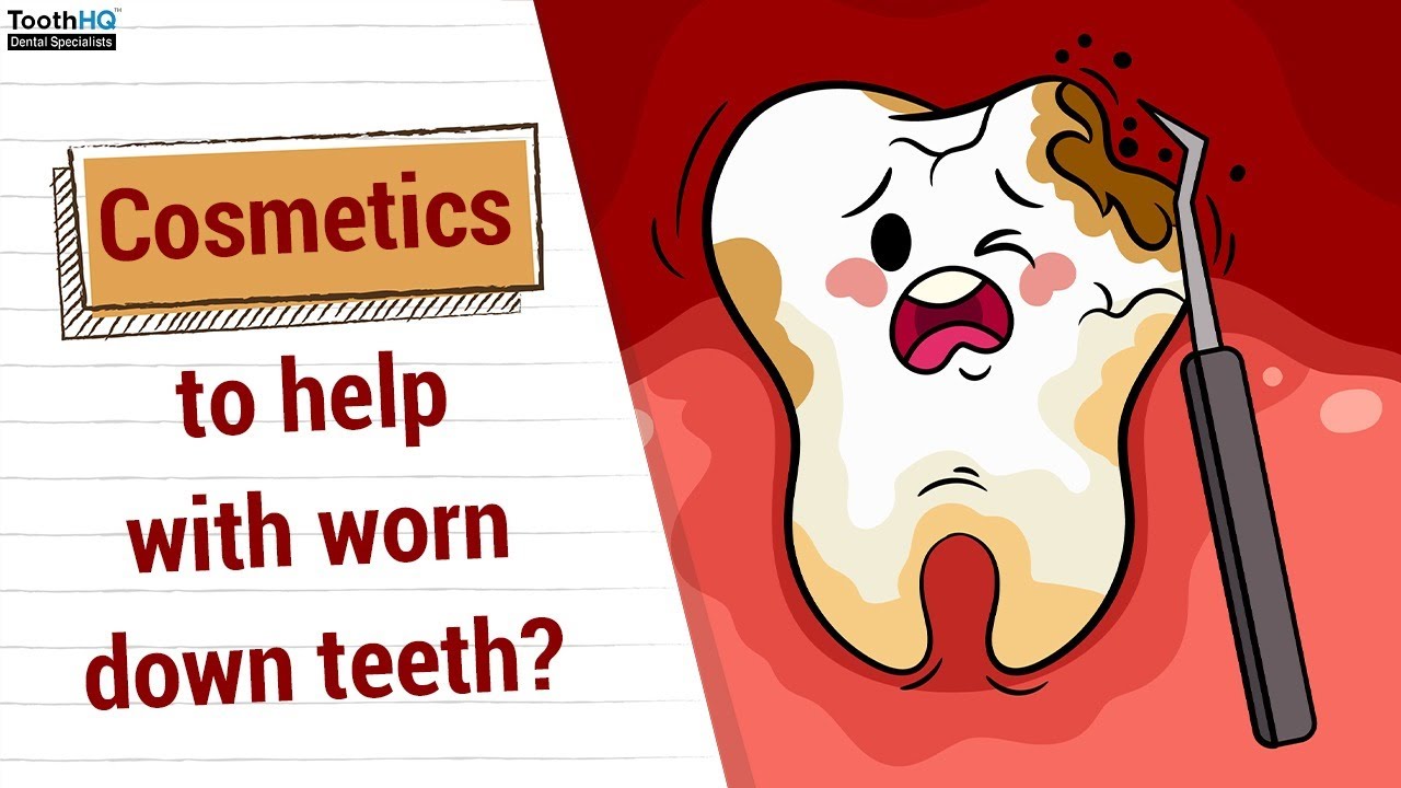 Cosmetics to help with worn down teeth?