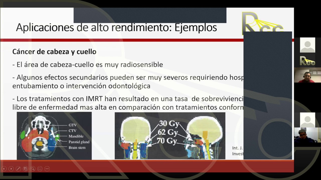 IMRT 2.0 LATAM | Sesi&oacute;n 1  | Introducci&oacute;n a la IMRT y planificaci&oacute;n del tratamiento de IMRT