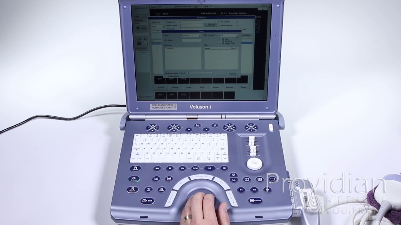 GE Voluson i Training Part 5: Exporting Images