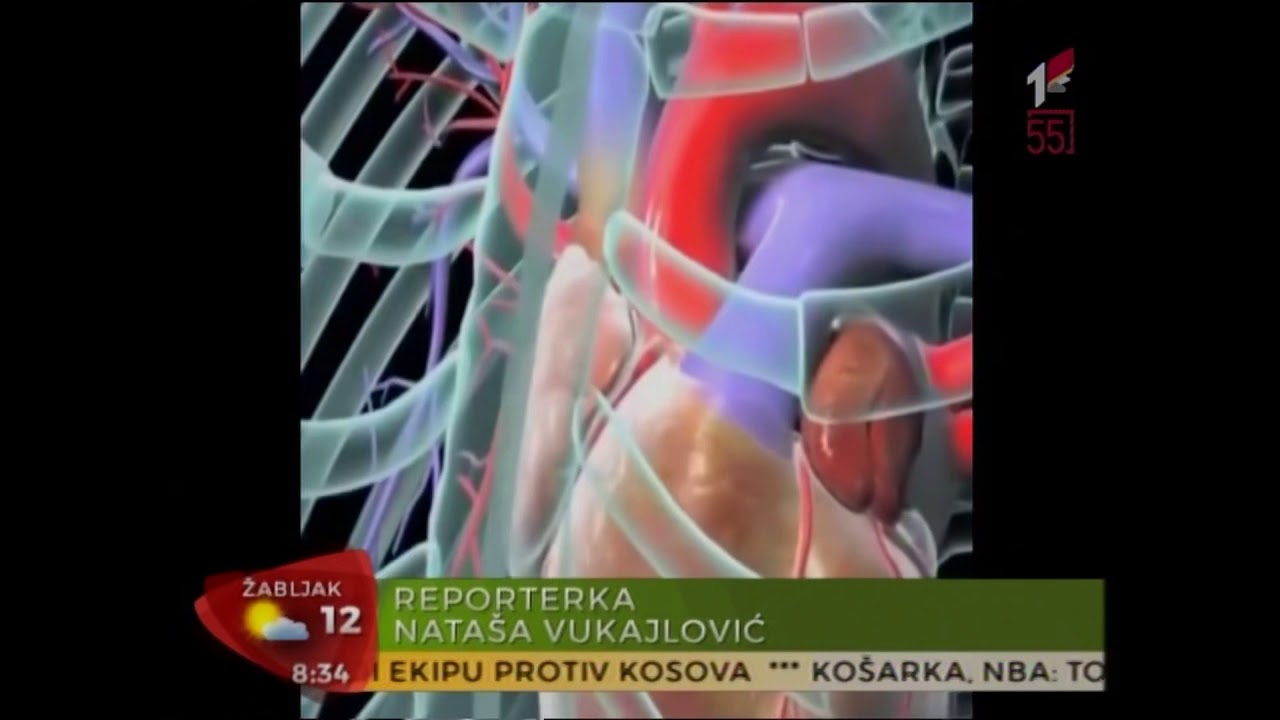 Dr Ognjen Novosel (kardiolog) - PROŠIRENA SRČANA I TRBUŠNA AORTA