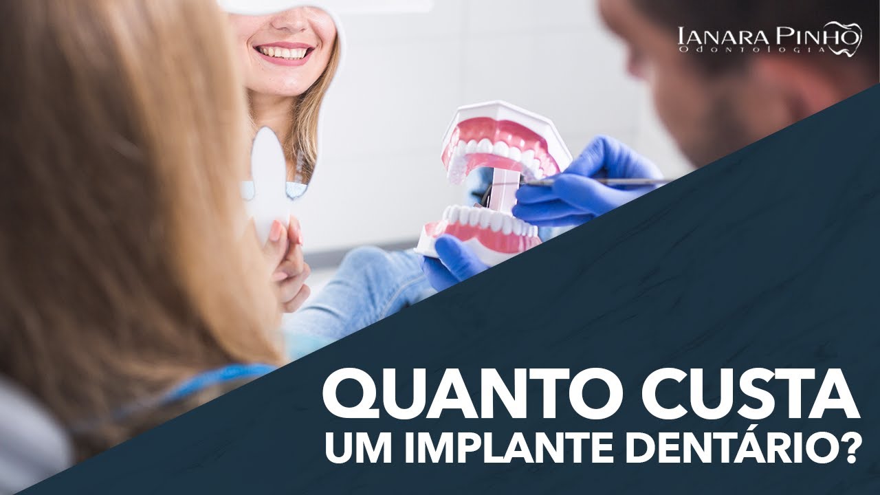 Quanto Custa um Implante Dent&aacute;rio? | Ianara Pinho