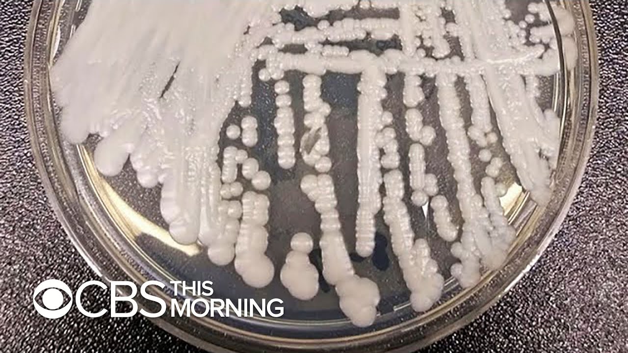 CDC warns about drug-resistant superbug fungus Candida auris