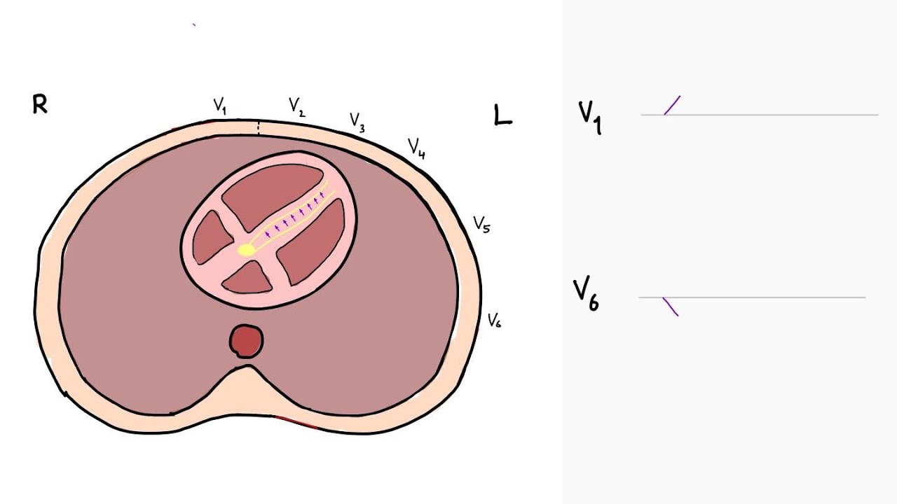 How to think about ECGs
