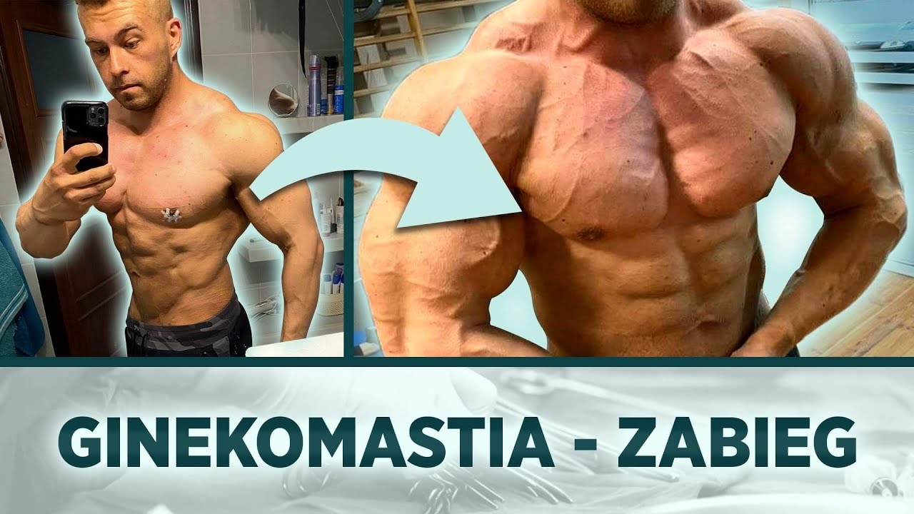 Ginekomastia - Zabieg
