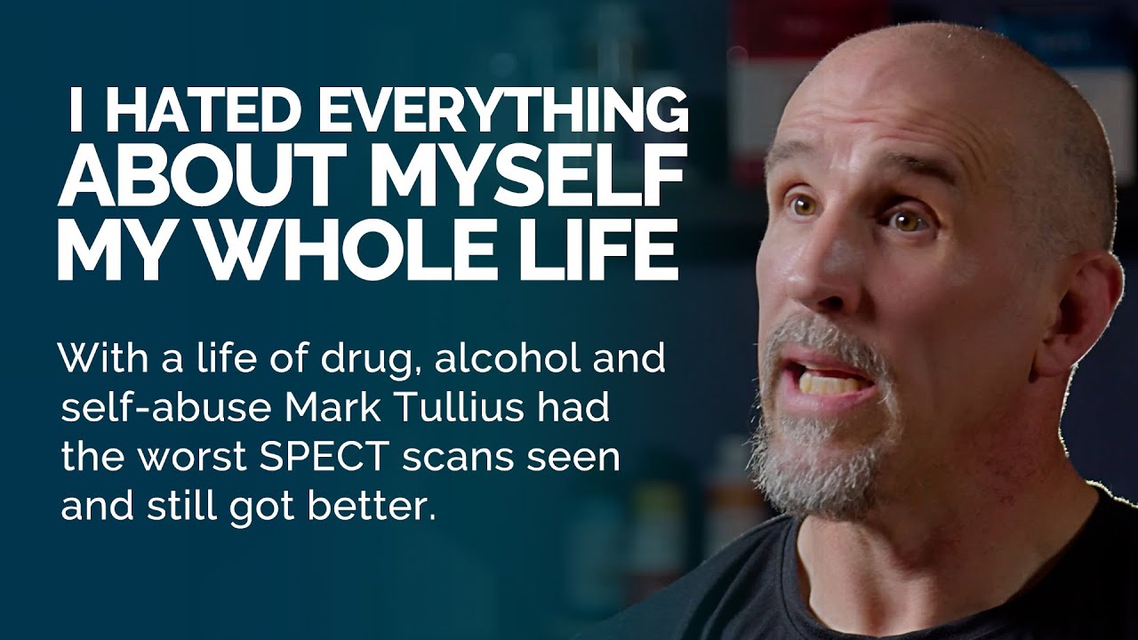 Even if You've Been Bad to Your Brain, You Can Begin to Heal it