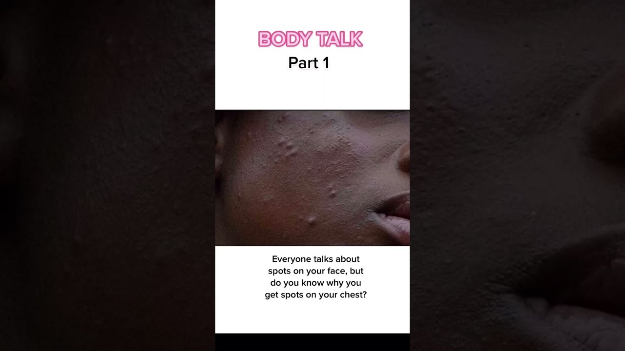 Why you get chest acne | Can&rsquo;t believe how many people don&rsquo;t know this 👀 #shorts