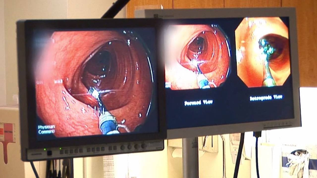 Video: Seven Symptoms of Colon Cancer