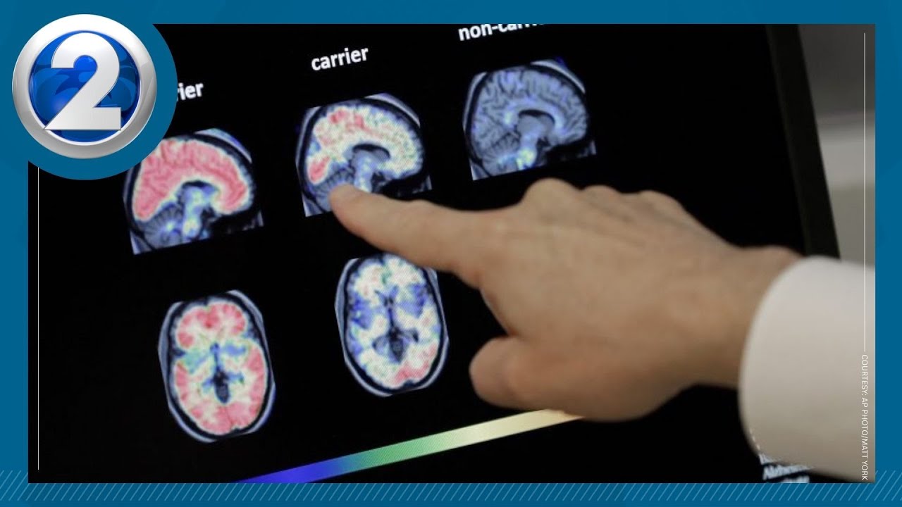 Kupuna Life: Alzheimer's & Dementia awareness