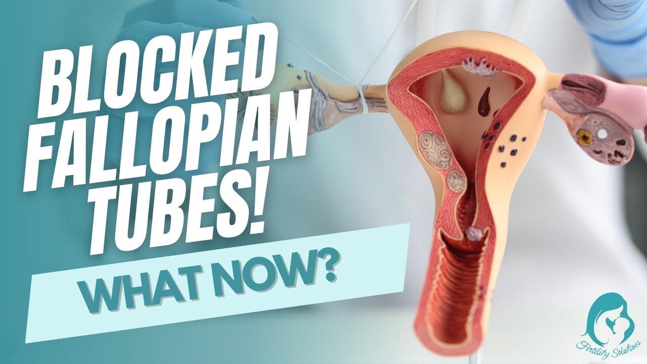 Dr Q  Blocked Fallopian Tubes what now