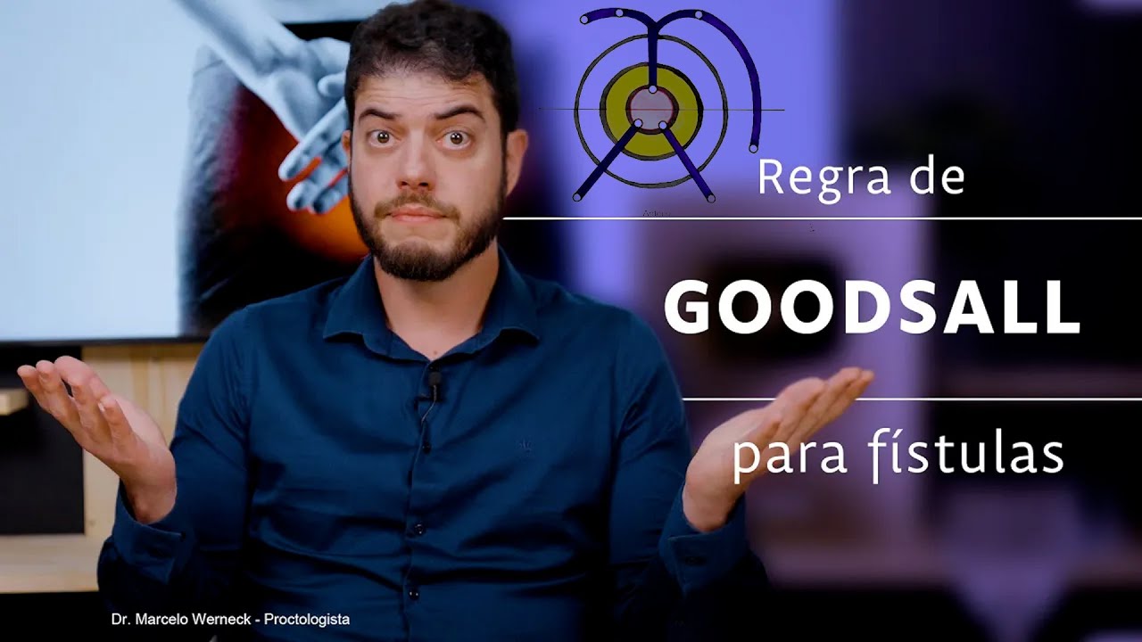 Regra de Goodsall para F&iacute;stulas