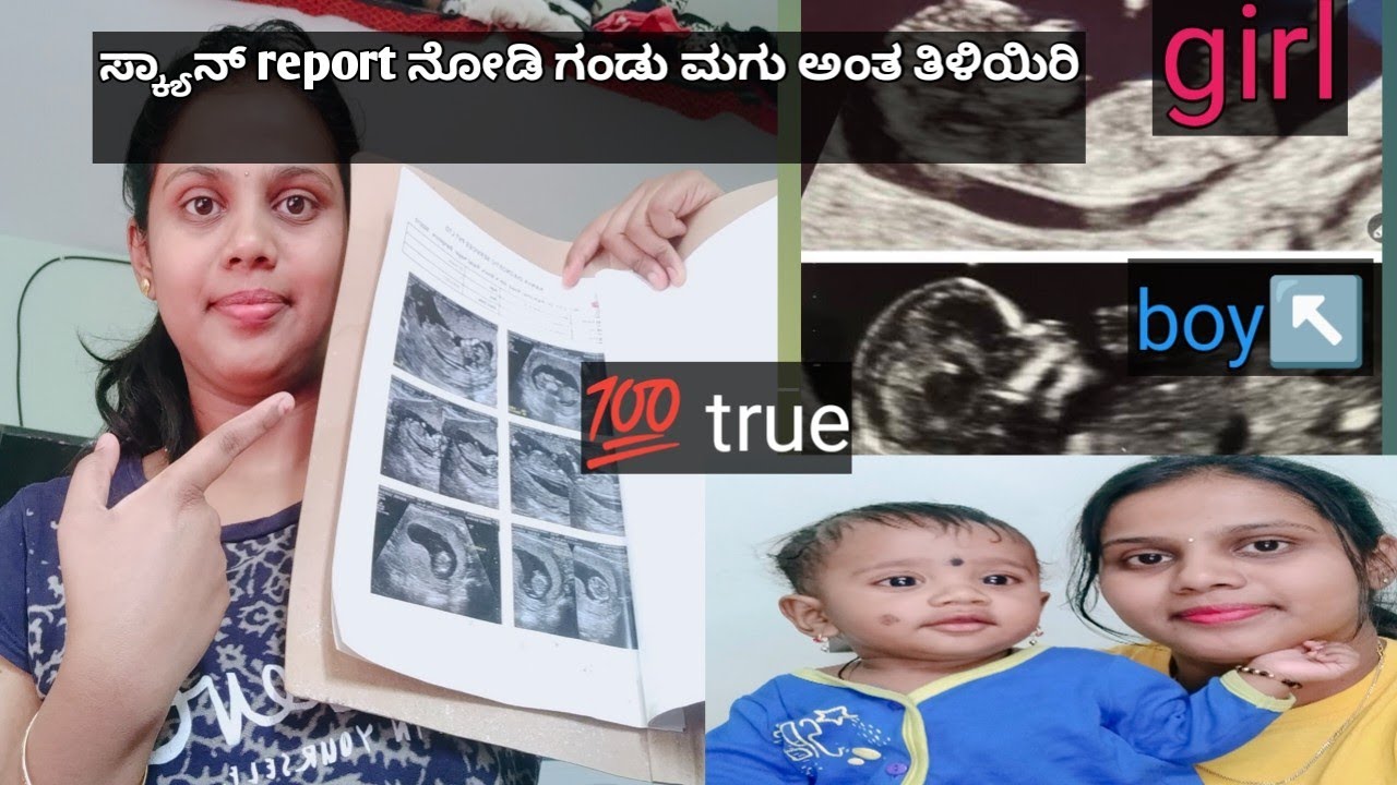 ಸ್ಕ್ಯಾನ್ report ನೋಡಿ ಗಂಡು /ಹುಡುಗಿ ಮಗು ಅಂತ ತಿಳಿಯಿರಿ