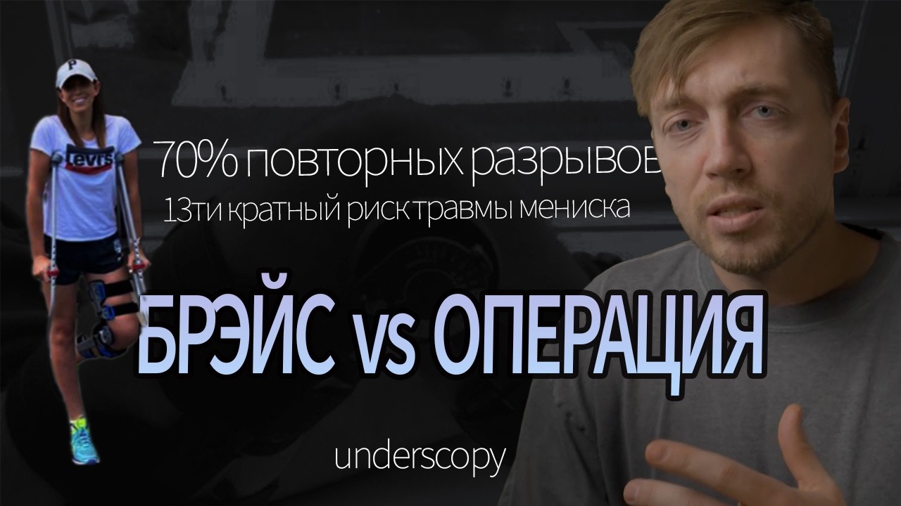 Неприемлимые риски CROSS BRACE PROTOCOL консервативного лечения разрыва пкс у спортсменов