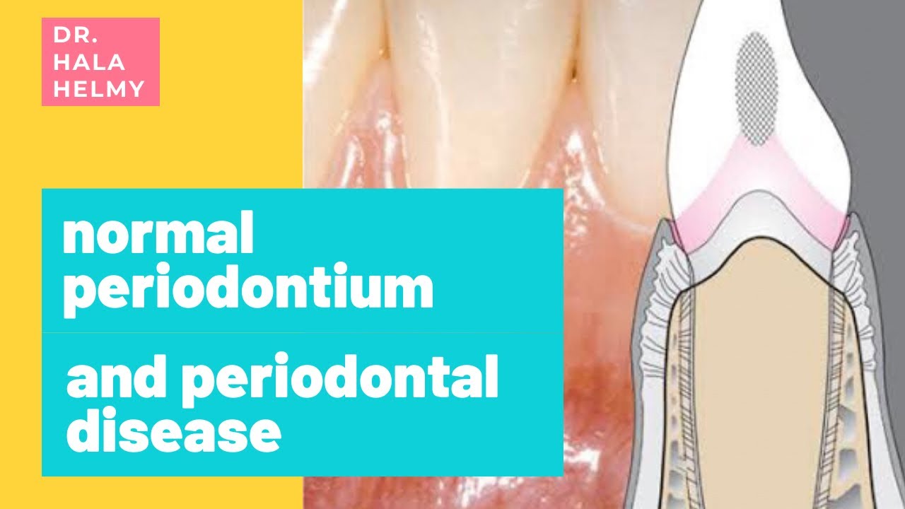 Intro of Periodontics | ( #1 Periodontal disease )