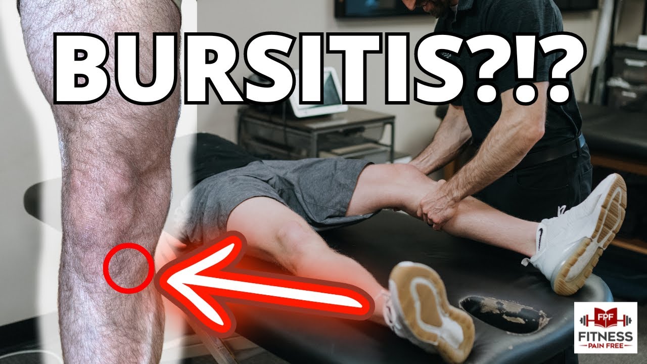 Pes Anserine Pain - What Physical Therapists Should Know