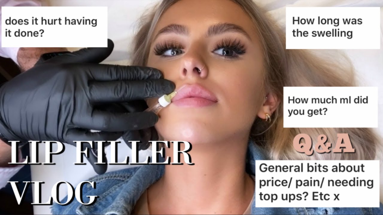COME WITH ME TO GET LIP FILLER | FILLER VLOG AND Q&A